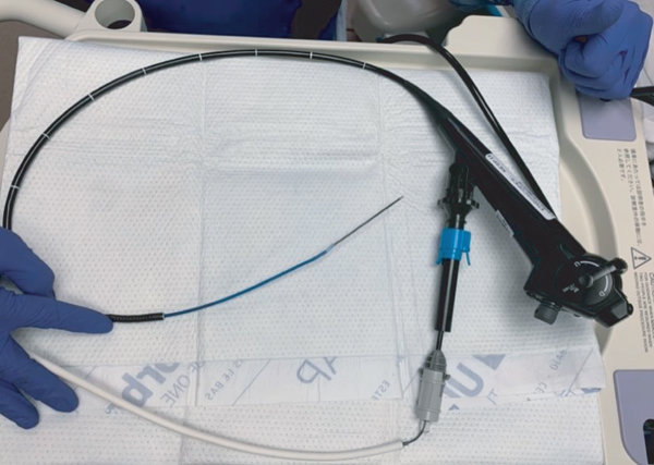 lung-ultrasound-treatmen